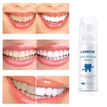 Charger l'image dans la galerie, Mousse de blanchissement dentaires