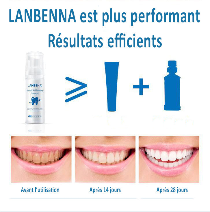 Mousse de blanchissement dentaires