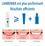 Charger l&#39;image dans la galerie, Mousse de blanchissement dentaires
